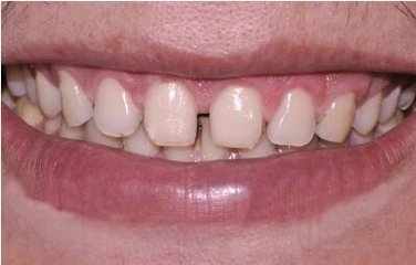 男人牙齿相学_牙齿在相学的意义_牙齿相学