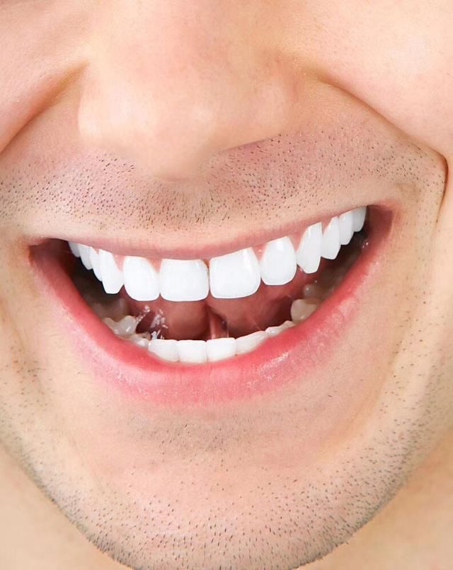 男人牙齿相学_牙齿在相学的意义_牙齿相学